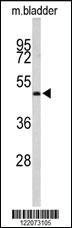 Anti-ACTR3B Rabbit Polyclonal Antibody