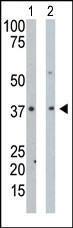 Anti-PDXK Rabbit Polyclonal Antibody (Biotin)