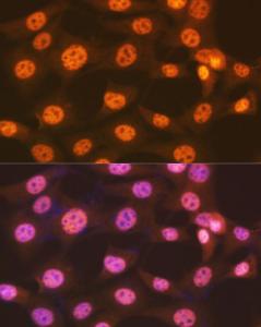 Immunofluorescence analysis of NIH-3T3 cells using Anti-ENT2 Antibody [ARC2234] (A306994) at a dilution of 1:100 (40x lens). DAPI was used to stain the cell nuclei (blue).