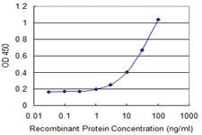 Anti-AXL Mouse Monoclonal Antibody [clone: 2C10]