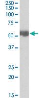 Anti-ALDH3A2 Goat Polyclonal Antibody