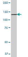 Anti-RNF111 Mouse Polyclonal Antibody