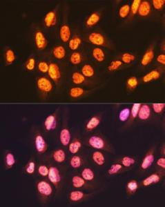 Immunofluorescence analysis of U-2 OS cells using Anti-ENT2 Antibody [ARC2234] (A306994) at a dilution of 1:100 (40x lens). DAPI was used to stain the cell nuclei (blue).