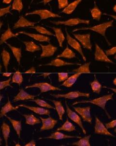 Immunofluorescence analysis of L929 cells using Anti-ABHD4 Antibody (A308120) at a dilution of 1:100. DAPI was used to stain the cell nuclei (blue).