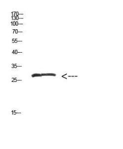 Western blot analysis of hepg2 cells using Anti-MYOZ2 Antibody