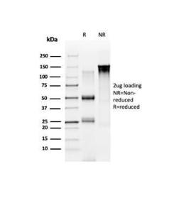 SDS-PAGE analysis of Anti-NOC4L Antibody [PCRP-NOC4L-1B2] under non-reduced and reduced conditions; showing intact IgG and intact heavy and light chains, respectively. SDS-PAGE analysis confirms the integrity and purity of the Antibody