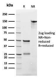 SDS-PAGE analysis of Anti-CD3 epsilon Antibody [rC3e/2479] under non-reduced and reduced conditions; showing intact IgG and intact heavy and light chains, respectively. SDS-PAGE analysis confirms the integrity and purity of the antibody.