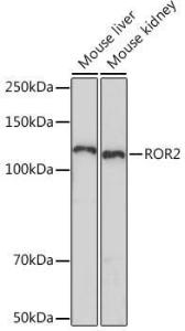 Western blot analysis of extracts of various cell lines, using Anti-ROR2 Antibody [ARC1197] (A306995) at 1:1,000 dilution