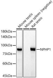 Western blot analysis of extracts of various cell lines, using Anti-NPHP1 Antibody [ARC52339] (A308121) at 1:1000 dilution. The secondary Antibody was Goat Anti-Rabbit IgG H&L Antibody (HRP) at 1:10000 dilution. Lysates/proteins were present at 25 µg per lane