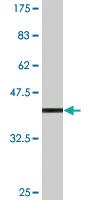 Anti-P3H4 Mouse Monoclonal Antibody [clone: 1E12]