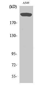 Western blot analysis of various cells using Anti-mTOR Antibody