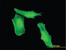 Anti-HRSP12 Mouse Monoclonal Antibody [clone: 2B8]