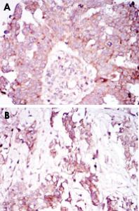 Anti-ATXN1 Mouse Monoclonal Antibody [clone: 2F5]