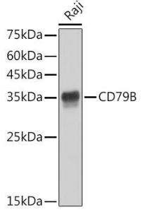 Western blot analysis of extracts of Raji cells, using Anti-CD79b Antibody [ARC52688] (A306997) at 1:1000 dilution. The secondary Antibody was Goat Anti-Rabbit IgG H&L Antibody (HRP) at 1:10000 dilution. Lysates/proteins were present at 25 µg per lane