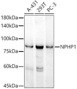 Western blot analysis of extracts of various cell lines, using Anti-NPHP1 Antibody [ARC52339] (A308121) at 1:1000 dilution. The secondary Antibody was Goat Anti-Rabbit IgG H&L Antibody (HRP) at 1:10000 dilution. Lysates/proteins were present at 25 µg per lane