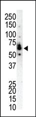 Anti-PRKCH Rabbit Polyclonal Antibody