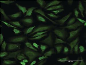 Anti-STIP1 Mouse Monoclonal Antibody [clone: 1C6]