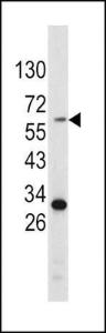 Anti-TYR Rabbit Polyclonal Antibody