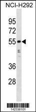 Anti-HNRNPH1 Rabbit Polyclonal Antibody (AP (Alkaline Phosphatase))