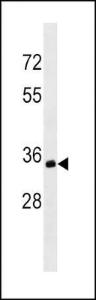 Anti-MS4A1, CD20 Mouse Monoclonal Antibody [clone: 407CT20.1.2]