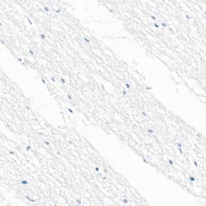 Immunohistochemistry analysis of paraffin-embedded human brain tissue using Anti-CD79b Antibody [ARC52688] (A306997) at a dilution of 1:100 (40X lens). Perform high pressure antigen retrieval with 10 mM citrate buffer pH 6.0 before commencing with IHC staining protocol