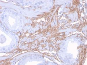 Immunohistochemical analysis of formalin-fixed, paraffin-embedded human prostate using Anti-Decorin Antibody [DCN/3523]