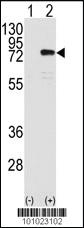 Anti-PRKCH Rabbit Polyclonal Antibody