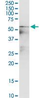 Anti-P3H4 Polyclonal Antibody Pair