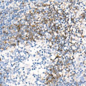 Immunohistochemistry analysis of paraffin-embedded human tonsil using Anti-CD79b Antibody [ARC52688] (A306997) at a dilution of 1:100 (40X lens). Perform high pressure antigen retrieval with 10 mM citrate buffer pH 6.0 before commencing with IHC staining protocol