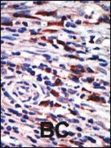 Anti-PRKCH Rabbit Polyclonal Antibody