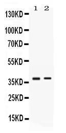 Anti-TNFRSF14 Rabbit Polyclonal Antibody