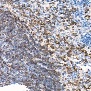 Immunohistochemistry analysis of paraffin-embedded mouse spleen using Anti-CD79b Antibody [ARC52688] (A306997) at a dilution of 1:100 (40X lens). Perform high pressure antigen retrieval with 10 mM citrate buffer pH 6.0 before commencing with IHC staining protocol