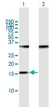 Anti-POP7 Mouse Polyclonal Antibody