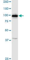 Anti-RNF111 Rabbit Polyclonal Antibody