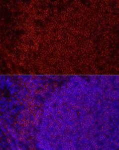 Immunofluorescence analysis of mouse spleen using Anti-CD79b Antibody [ARC52688] (A306997) at a dilution of 1:100 (40X lens). DAPI was used to stain the cell nuclei (blue)