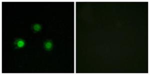 Immunofluorescence analysis of HUVEC cells using Anti-MSH2 Antibody. The right hand panel represents a negative control, where the antibody was pre-incubated with the immunising peptide.