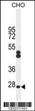 Anti-CF062 Rabbit Polyclonal Antibody (FITC (Fluorescein Isothiocyanate))