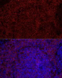 Immunofluorescence analysis of rat spleen using Anti-CD79b Antibody [ARC52688] (A306997) at a dilution of 1:100 (40X lens). DAPI was used to stain the cell nuclei (blue)