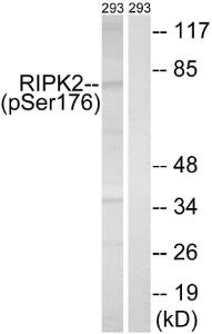 Western blot analysis of lysates from 293 cells treated with UV 15' using Anti-RIPK2 (phospho Ser176) Antibody. The right hand lane represents a negative control, where the antibody is blocked by the immunising peptide