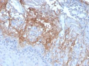 Immunohistochemical analysis of formalin-fixed, paraffin-embedded human skin using Anti-Decorin Antibody [DCN/3523]