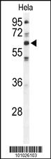 Anti-PRKCI Rabbit Polyclonal Antibody