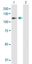 Anti-ITGB1 Rabbit Polyclonal Antibody