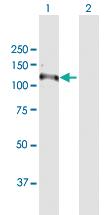 Anti-RNF111 Rabbit Polyclonal Antibody