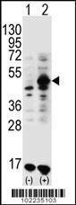 Anti-GDF9 Rabbit Polyclonal Antibody (AP (Alkaline Phosphatase))