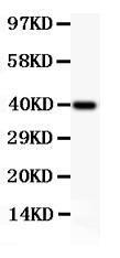 Anti-NFkB p100/p52 Polyclonal Antibody