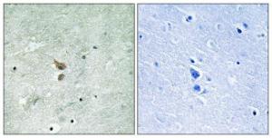 Immunohistochemical analysis of paraffin-embedded human brain using Anti-RIPK2 (phospho Ser176) Antibody. The right hand panel represents a negative control, where the antibody was pre-incubated with the immunising peptide