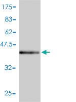 Anti-PRKD1 Mouse Monoclonal Antibody [clone: 2G2-1F1]