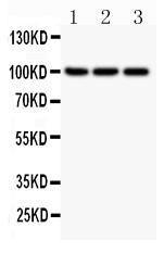 Anti-NFkB p100/p52 Polyclonal Antibody