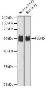 Western blot analysis of extracts of various cell lines, using Anti-Fibulin 5 Antibody (A12432) at 1:1000 dilution. The secondary Antibody was Goat Anti-Rabbit IgG H&L Antibody (HRP) at 1:10000 dilution. Lysates/proteins were present at 25 µg per lane