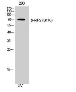 Western blot analysis of 293 cells using Anti-RIPK2 (phospho Ser176) Antibody